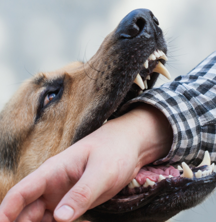 Dog Bites